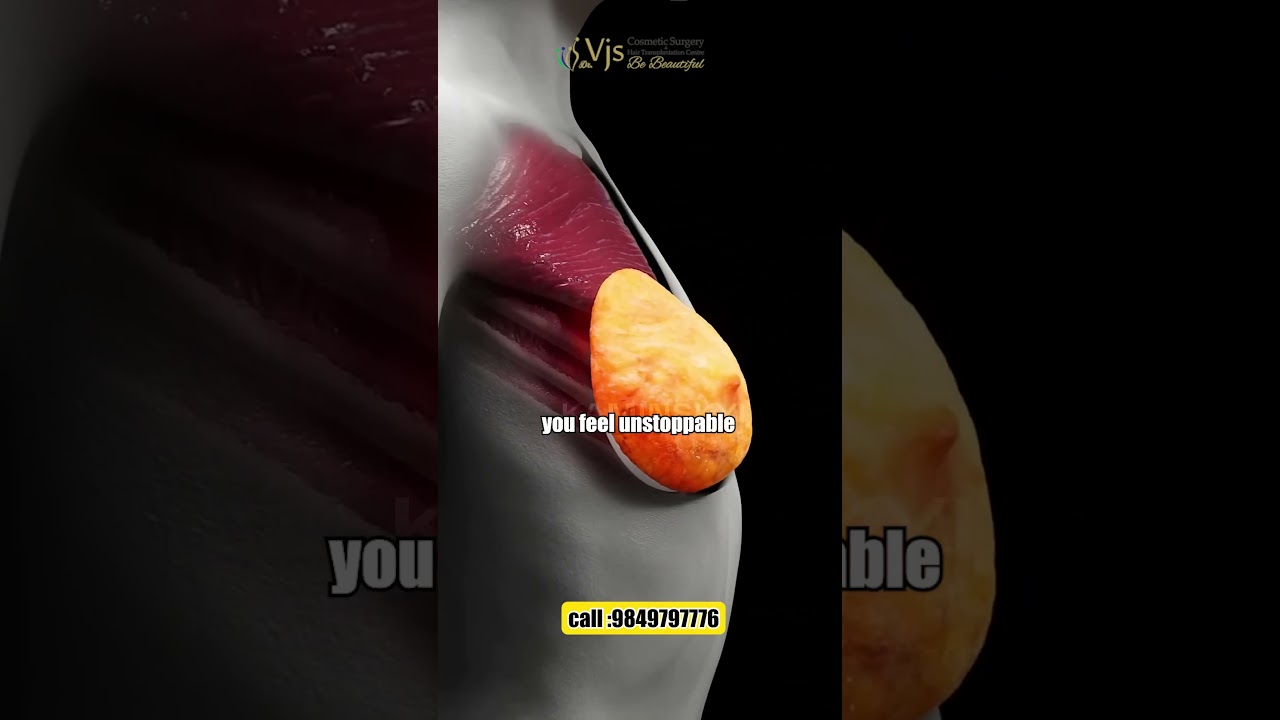 Feel Confident in Your Own Skin | Breast Augmentation in Vizag | What Changes Beyond Looks?