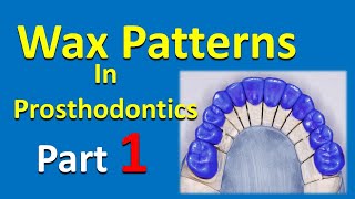Wax Patterns in prosthodontics part 1