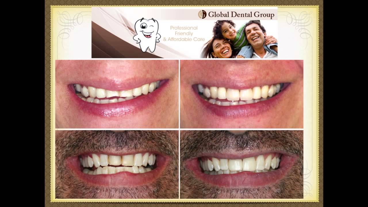 Best Dentist Mission Viejo - Industry Leading Cosmetic and General