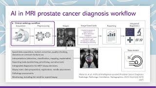 Prostate Cancer Detection Using Artifical Inteligence (AI) Software - 2023 Update