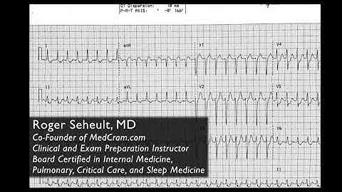 Basic of ECG/EKG Part 2- Explained Clearly with Example of ECG