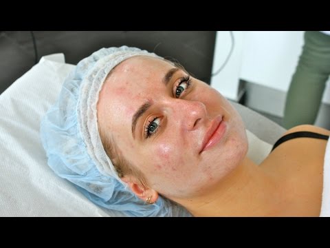 Wideo: Wielokwasowe peelingi chemiczne do twarzy