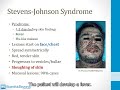 7.9 Hypersensitivity Disorder 