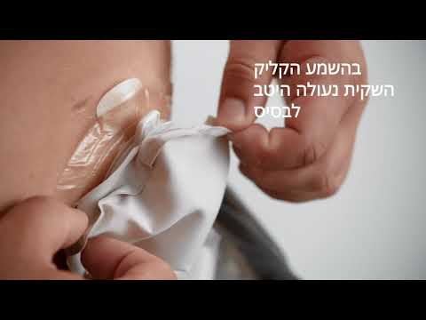 וִידֵאוֹ: מהם היתרונות והחסרונות של סגירת סטומטה כאשר מים מועטים?