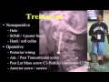 Odontoid and Cranio-Cervical Controversies by Rick C. Sasso, M.D.