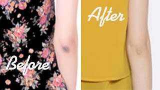 How to Get Rid of Dark Elbows and Knees fast in 5 minutes screenshot 5