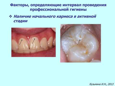 Профессиональная гигиена полости рта Агоритм, методы и средства