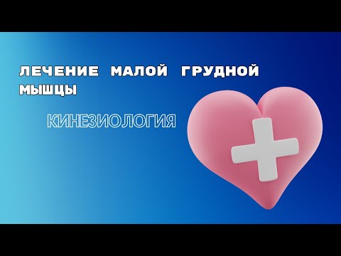 Лечение малой грудной мышцы