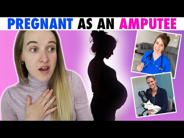 4 Things to Consider When You're a Pregnant Amputee Mommy