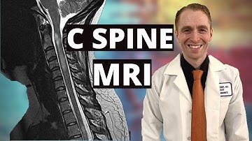 Neurologist Reviews Cervical Spine MRI [Multiple Sclerosis with Enhancing Lesions]