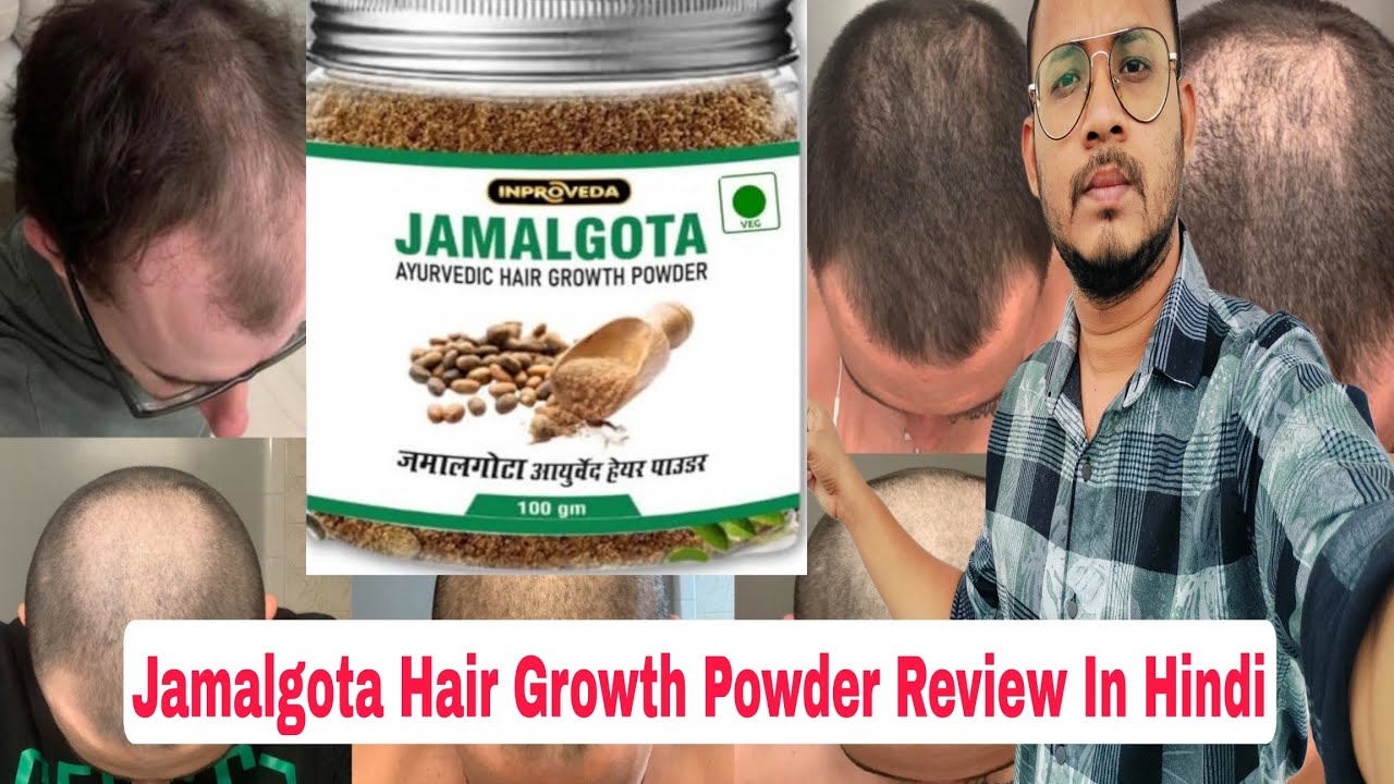 Jamalgota Hair Growth Powder Review In Hindi 