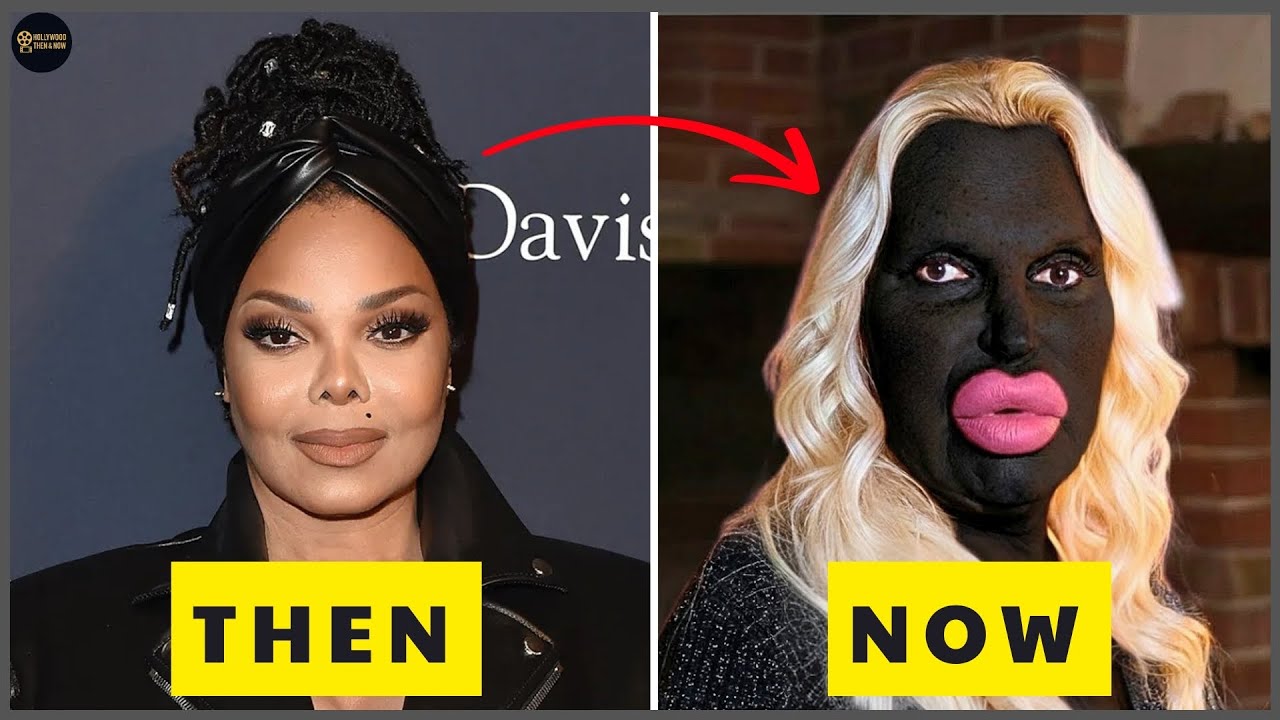 10 SHOCKING Plastic Surgery Disasters of Black Celebrities You Won’t