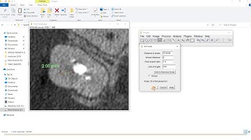 Area measurement using Image J