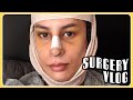 the day of my facial feminization surgery (FFS)