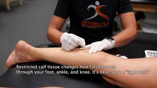 Dry Needling the Calf & Glute — Why Runners Can't Ignore These Two Muscles