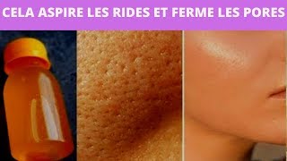 Cela aspire 20 ans de peau ancienne et ferme les pores - éclaircit et stimule le collagène.