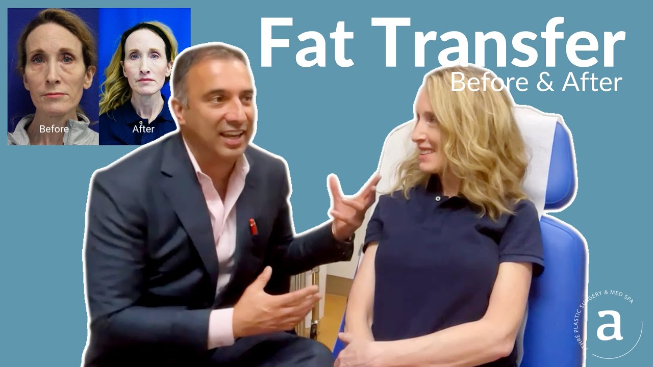 Пересадка жира до и после | Добавьте объёма и омолаживайте лицо