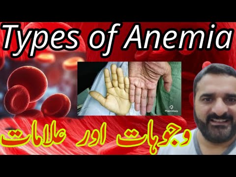 Anemia Types