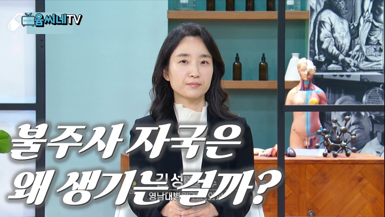 [TBC 건강365]  불주사 자국은 왜 생기는걸까? 켈로이드 전격분석❗ ㅣ 김성은 교수(성형외과)
