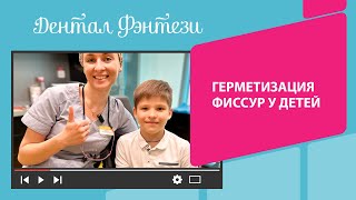 👩‍👦 Герметизация фиссур  у детей