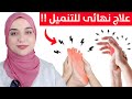علاج تنميل ورعشة اليدين و القدمين التخلص من الوخز و الرعشة و ضعف الاعصاب 
