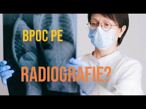 BPOC se vede la radiografie?