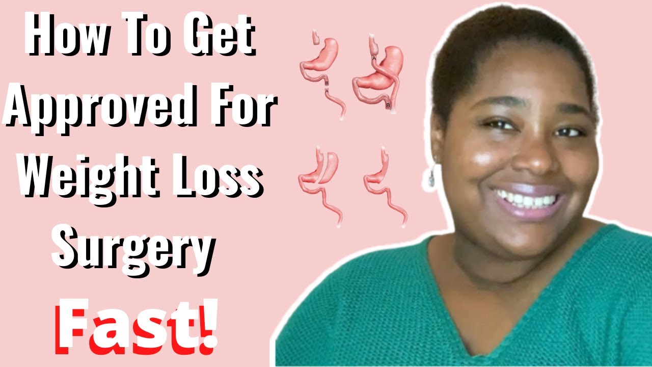 How To Get Approved For Weight Loss Surgery Fast YouTube