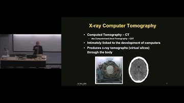 Speaking of Engineering - How Engineering has Revolutionized Brain Imaging
