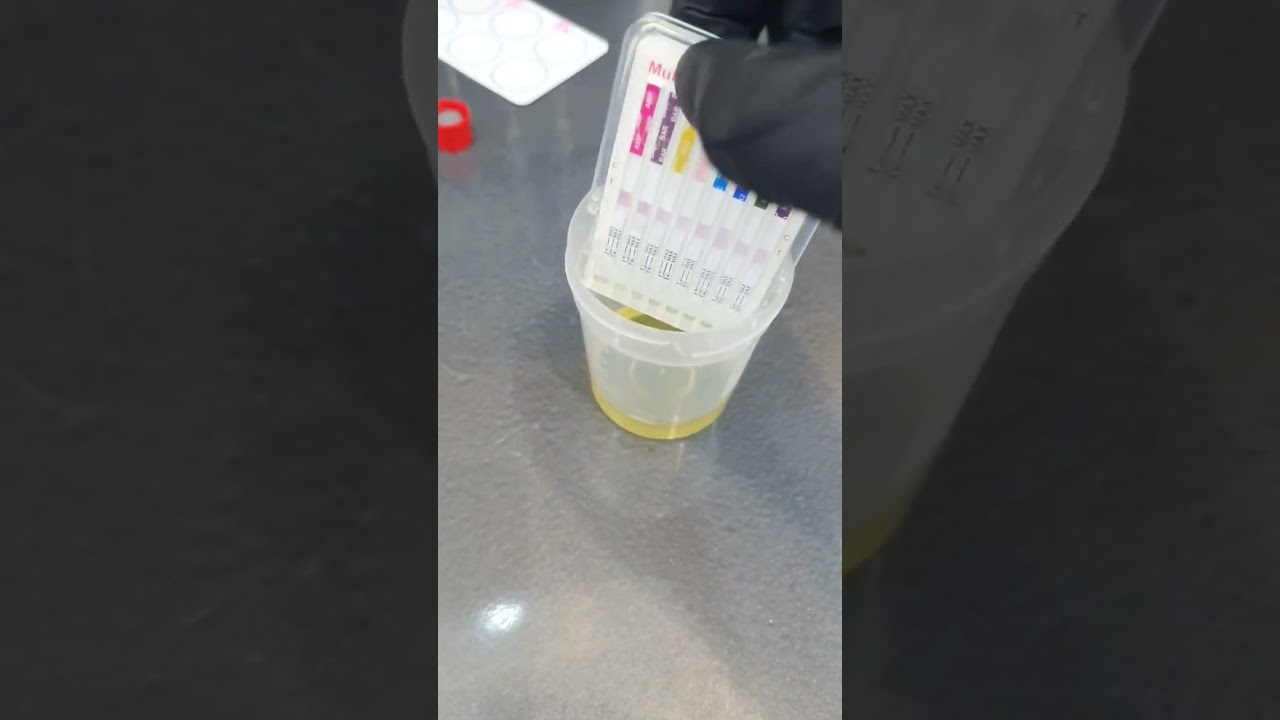 Urine drug test tutorial
