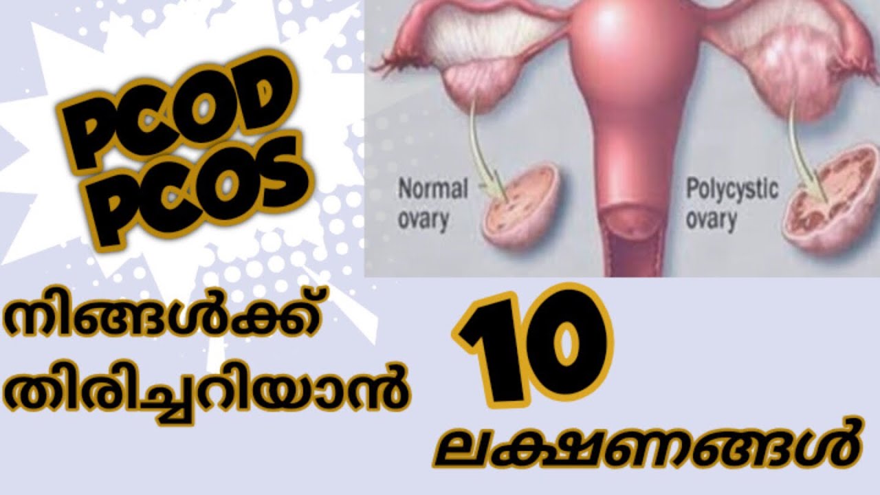 PCOD ഈ ലക്ഷണങ്ങൾ നിങ്ങൾക്കുണ്ടോ.?//PCOS/Part02/10Symptoms Malayalam