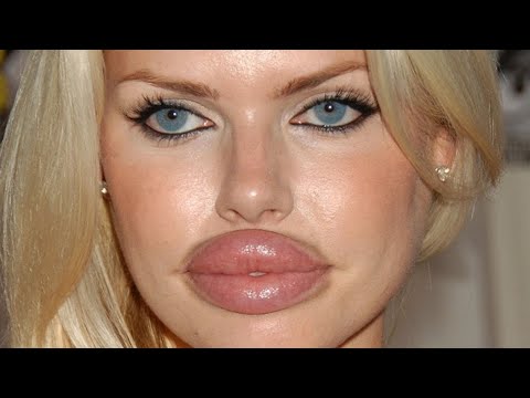 worst-plastic-surgery-fails-ever!