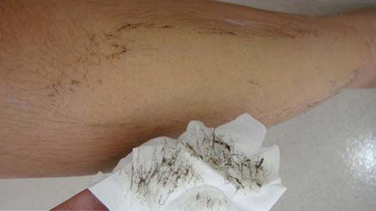 5 मिनिट में पुरे शरीर के अनचाहे बाल ऐसे खत्म हो जायेंगे की दोबारा नहीं आयेंगेUNWANTED HAIRS - YouTube