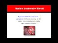 Fibroid All About Management 