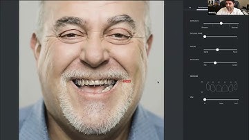 Introduction to Facially Guided Dental Mock-Ups - South Africa Academy of Aesthetic Dentistry