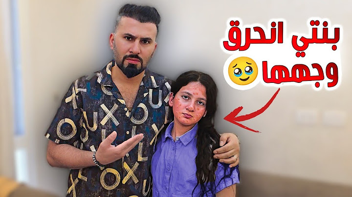 انحرق وجه ميرا 😥اخدناها على المستشفى -ليش صار هيك  😭