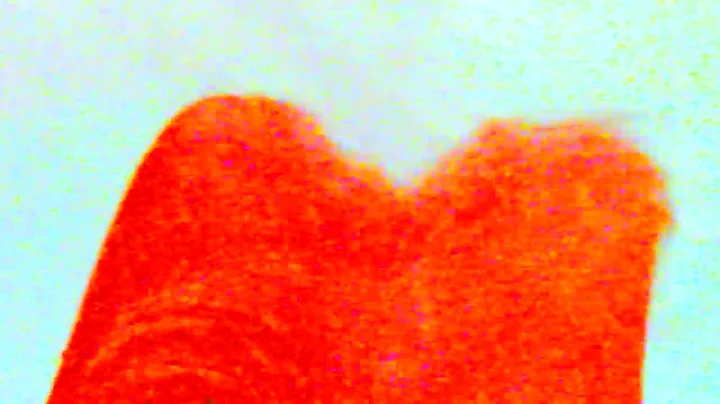 MOUTH