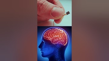 Neuralink Vs Blackrock Neurotech #neurotechnology  #bci  #neuralink #elonmusk