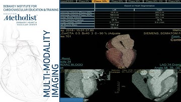CMR & CT Assessment of LV Function and Hemodynamics (D. Shah, MD & S. Chang, MD) September 25, 2018
