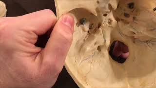 3 Minute Paranasal Sinuses