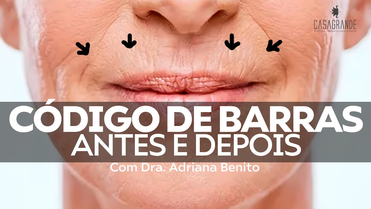 RESOLVENDO O CÓDIGO DE BARRAS - ANTES E DEPOIS - YouTube