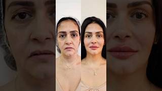 😱Dra Alessandra Bergamo impressiona com harmonização facial incrível 😱 Assista e se inscreva!