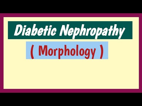 Diabetic Nephropathy - Pathology