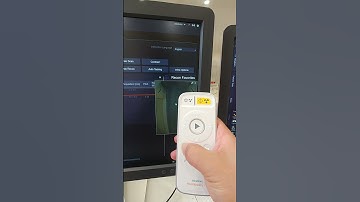 Siemens CT(Somatom go top) - Camera function& remote controller demonstration