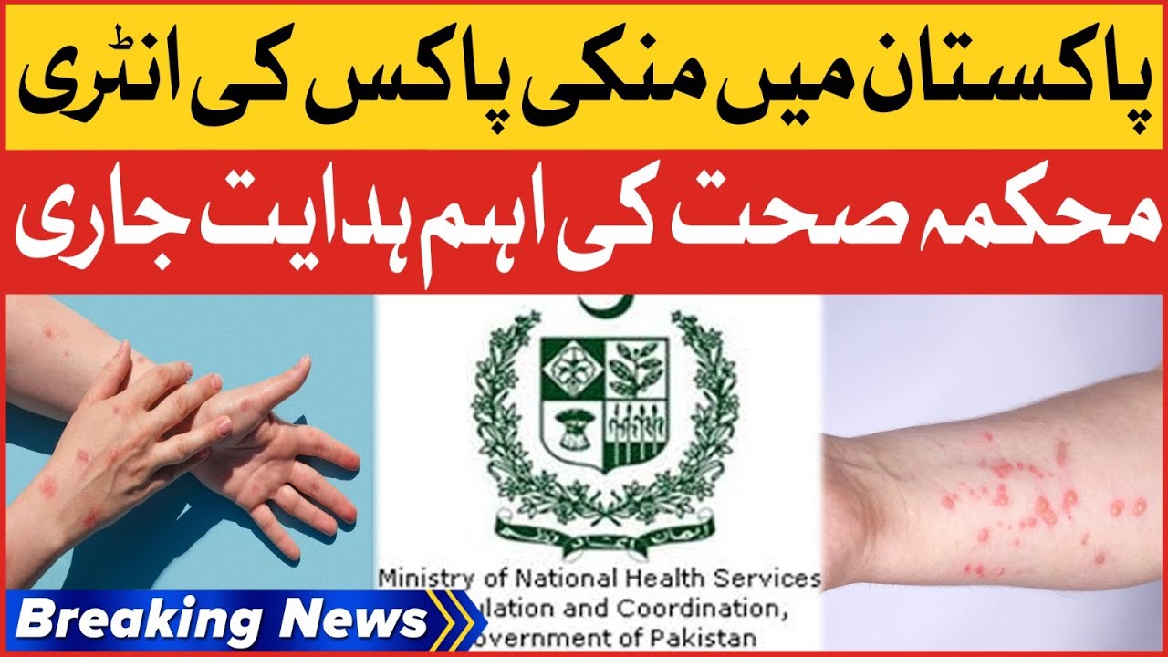 Monkeypox Virus In Pakistan | First Case Reported | Breaking News - YouTube