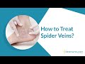 Spider Veins Treatment - Sclerotherapy