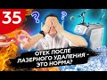 Отек после лазерного удаления - это норма?