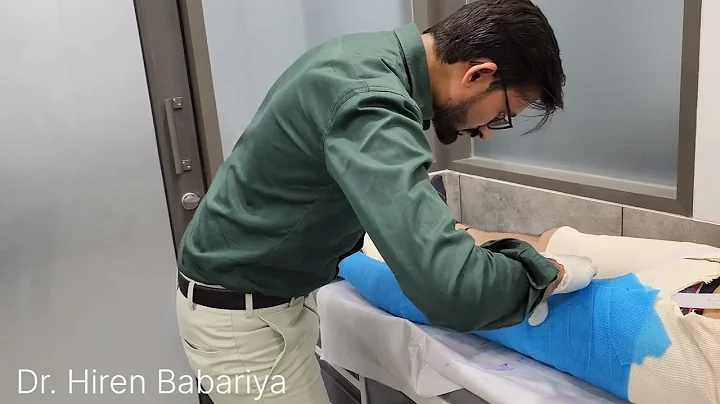 KAFO fabrication | Inspire Health Care | Fiber Glass Casting