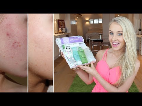 How I Cleared Up My Skin! - YouTube