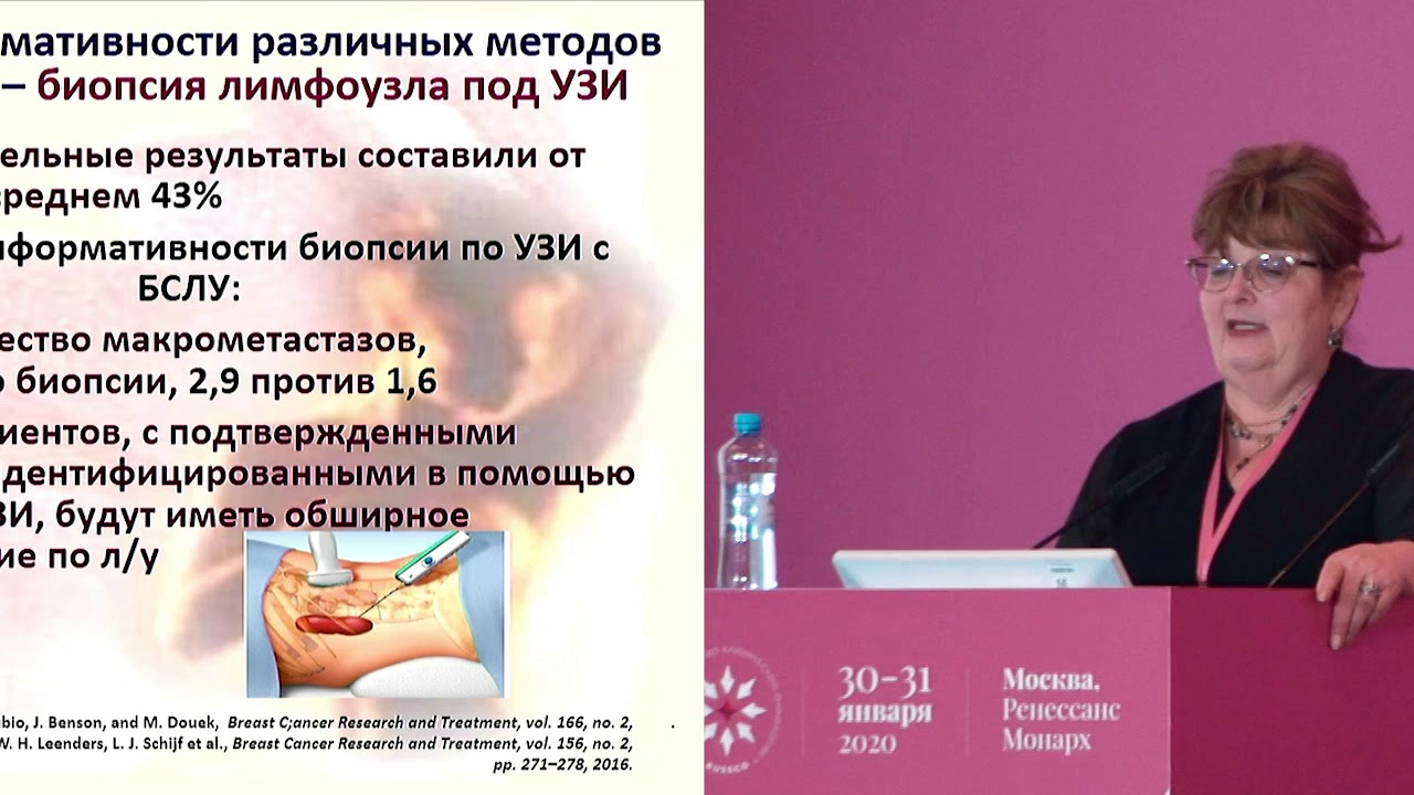 Как выбрать правильную тактику аксиллярной хирургии в отсутствие ...