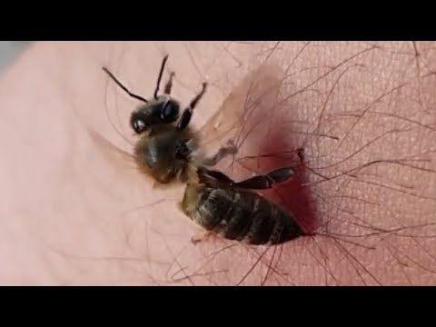 شاهد لسعة نحلة عن قرب Honey Bee Sting Close Up